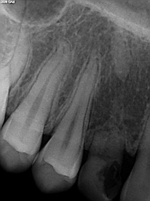 implant14 66 800 600 80